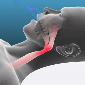 Kyvo™ - Sleep Apnea & Anti-Snoring Guard